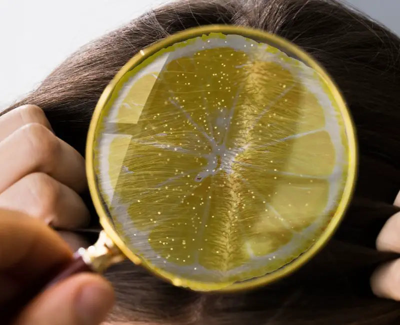 Lemon for dandruff and itchy scalp
