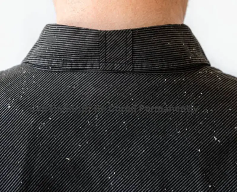 Can Dandruff Be Cured Permanently
