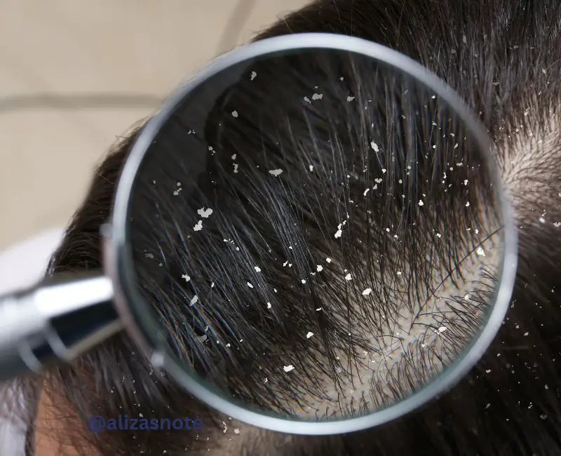 Why Do I Have Oily Hair And Dry Scalp