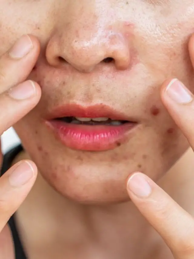 Best Skin Care Routine