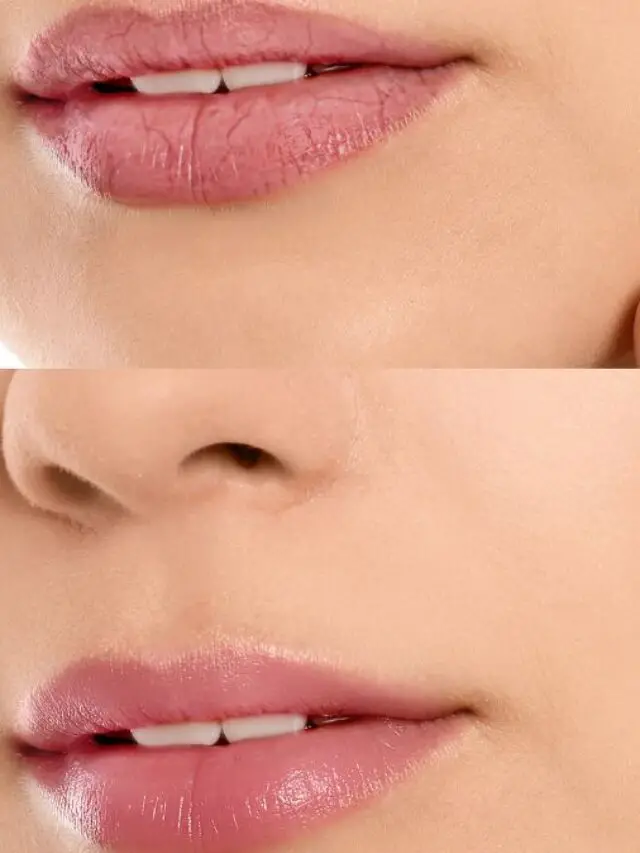 Lip Care Tips