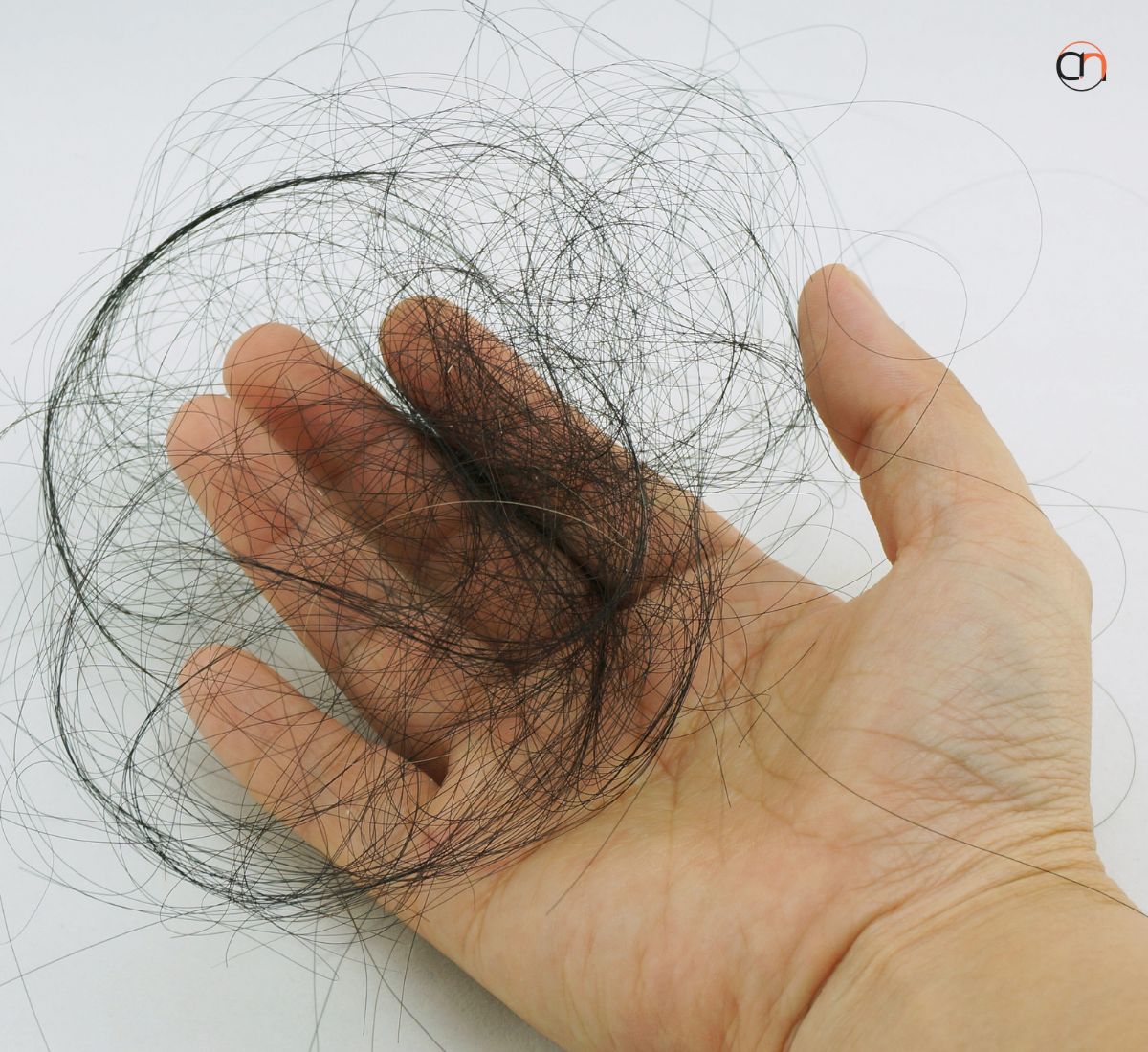 what vitamins affect hair loss