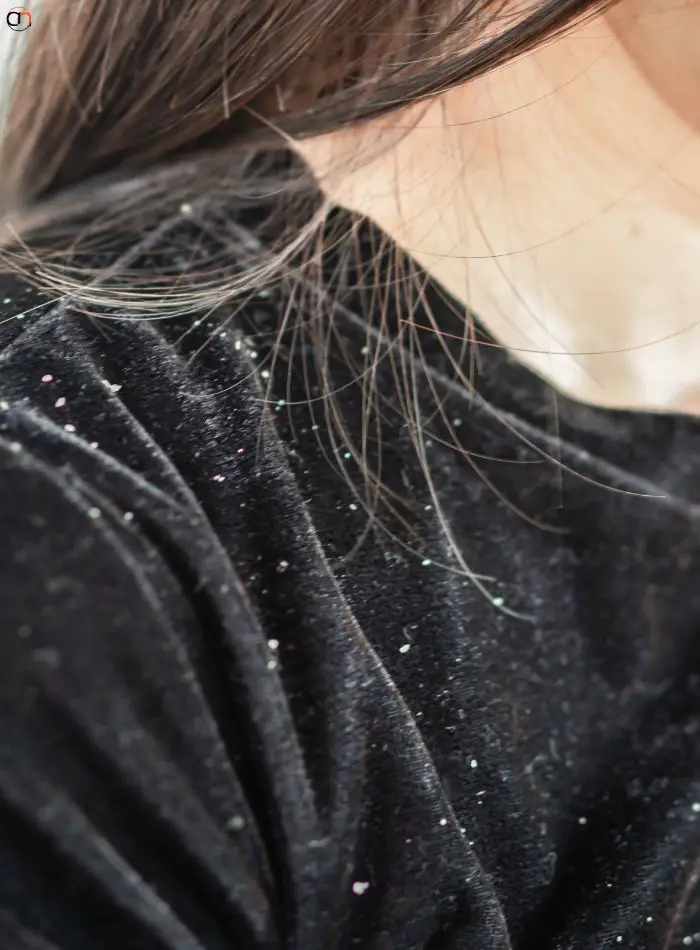 Causes of Winter Dandruff