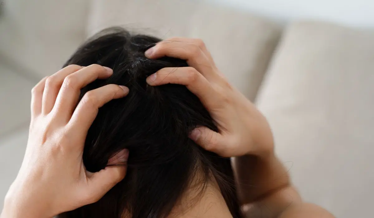 How To Remove Dandruff From Scalp