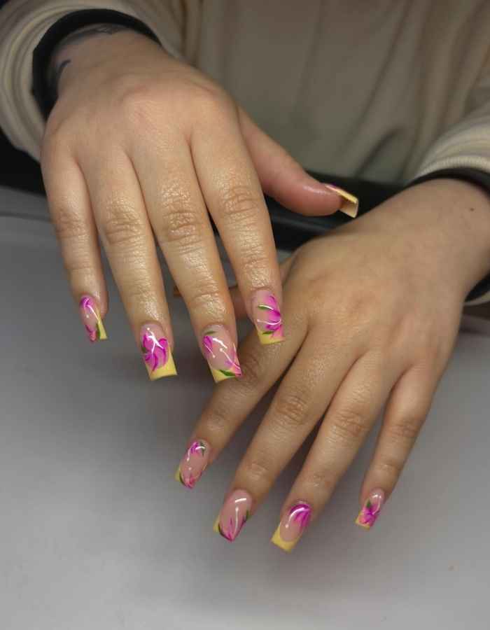 Yellow Nails