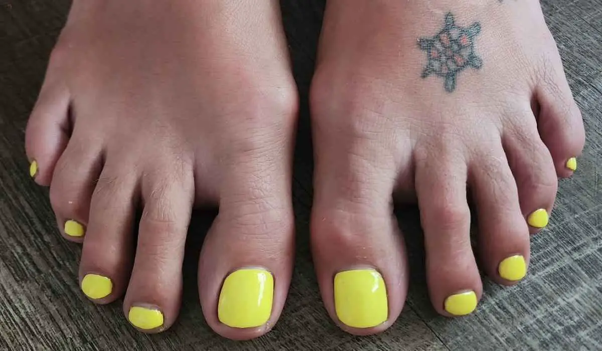 Yellow Toe Nails